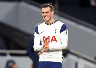 Bale lastra al Tottenham