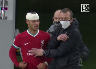 El impactante golpe que dejó a Thiago de esta guisa