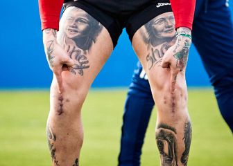 El Chimy presume de cicatrices