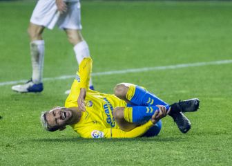 Benito como moneda de cambio