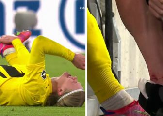 ¿Llega a la Champions? la fea lesión que sacó a Haaland del clásico