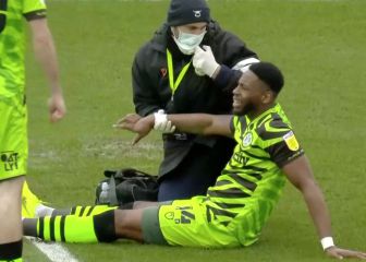 Se le dislocan cuatro dedos de una mano tras feo choque: imágenes durísimas