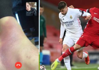 Así estaba el pie de Valverde antes del partido de Anfield