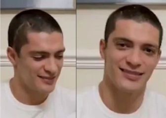 Raúl Jiménez jugará con casco toda su carrera