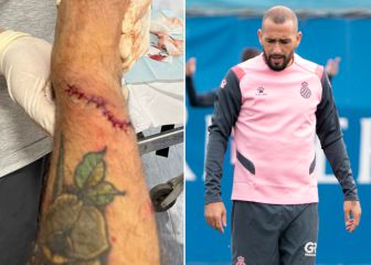 Aleix Vidal vuelve a Sevilla solo cinco días después de su herida