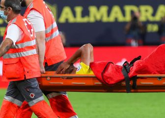Alivio para el Cádiz: la lesión de Fali no es grave como se temía