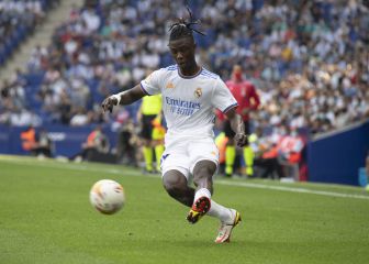 Fuerte hematoma de Camavinga en el pie