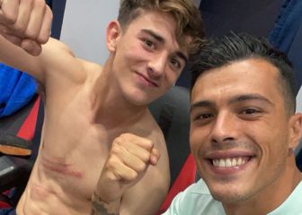 Terrible: así quedó el pecho de Gavi tras el partido