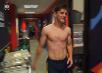 Gavi desvela quién le hizo el aparatoso raspón en el pecho