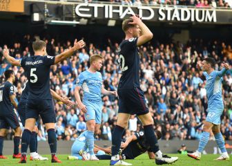 El City es mucho para el Burnley