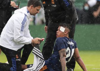 Mariano: operación y máscara