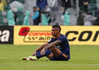 Mariano muestra su rostro tras 'partirse' la cara ante el Elche