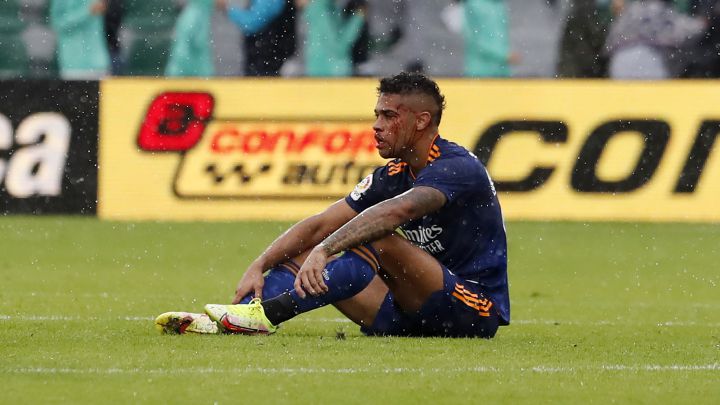 Mariano Díaz, delantero del Real Madrid, con la cara ensangrentada en Elche.