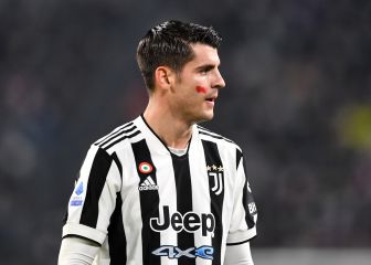 ¿Por qué los jugadores de la Serie A salen con una mancha roja en la cara?