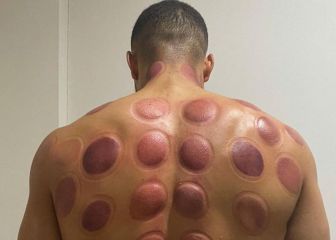 Danjuma se suma al 'metodo Benzema'... ¡Así quedó su espalda!