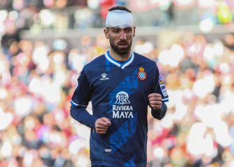 Darder para el golpe