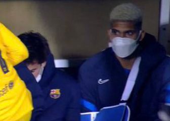 Pesimismo con Araújo: fractura en el metacarpiano de la mano derecha