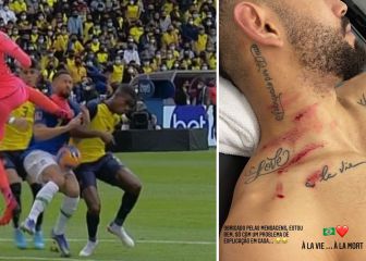 Cunha se toma con guasa la patada en el cuello: 