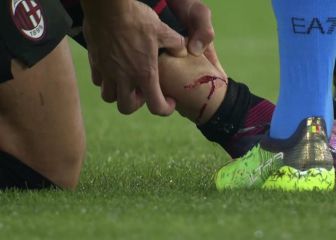 La escalofriante herida de Giroud