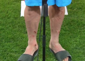 El estado de las piernas de Herrera tras Old Trafford