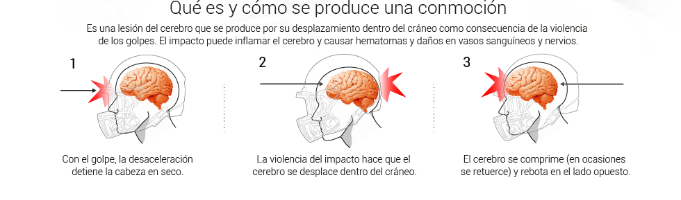 Gráfico Conmoción por Impacto