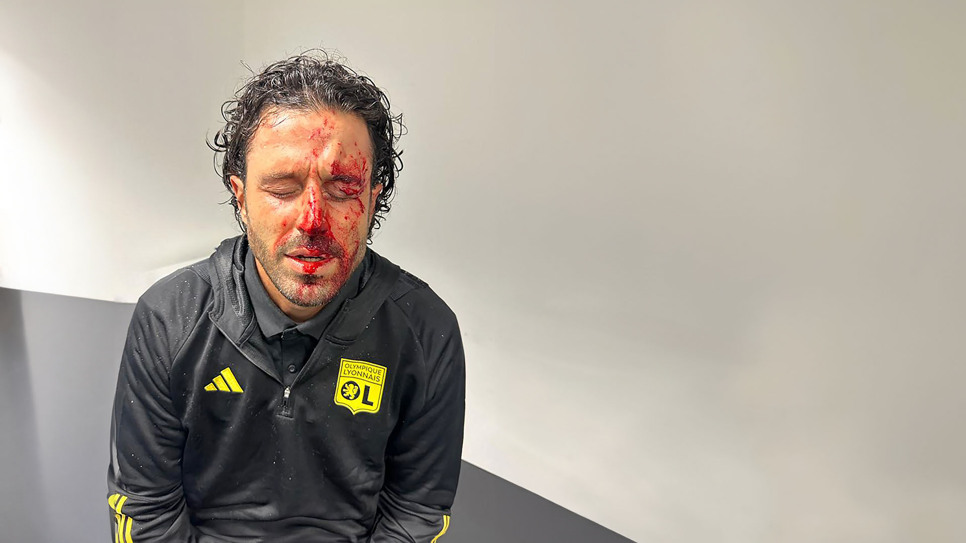 El 29 de octubre, un apedreamiento al autobús del Lyon por parte de radicales del Marsella ocasionó una grave herida a Fabio Grosso, entrenador del Lyon. El autocar quedó completamente destrozado y el OM-Lyon se suspendió, disputándose, con público, en el Vélodrome, el día 6 de diciembre.