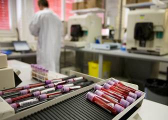 La AMA retira la acreditación al laboratorio de París