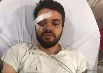 Un jugador de rugby argentino sufre una paliza por ser gay