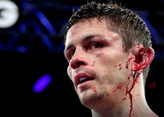 Smith acabó con la oreja partida en el combate contra Vargas