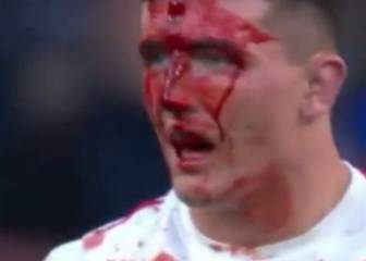 El escalofriante corte en la frente de un jugador de rugby