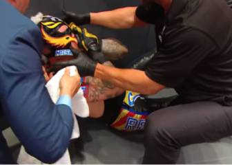 El ojo de Rey Misterio en estado crítico