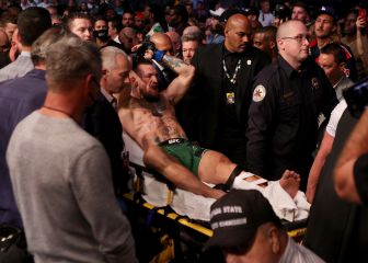 Una escalofriante fractura de tibia deja KO a McGregor