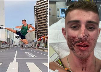 Asaltan a un taekwondista olímpico y termina con la cara desfigurada