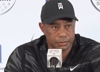 La reacción viral de un periodista cuando Tiger le dice que la amputación fue una opción real