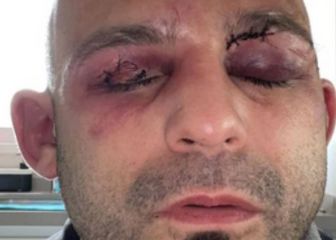 El boxeo alaba a Kiko Martínez: 