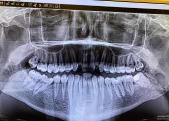 Kiko Martínez fracturó la mandíbula a Josh Warrington