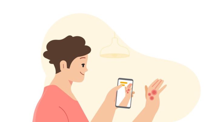Identificar un cáncer de piel con sólo la cámara del móvil, una herramienta IA de Google