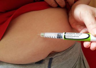 Insulina autoajustable, la última ayuda para sobrellevar la diabetes tipo 1