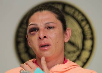 Ana Guevara da su versión de los hechos sobre su ataque