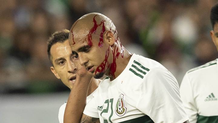 Luis 'Chaka' Rodríguez sufrió golpe que lo hizo sangrar de la cabeza
