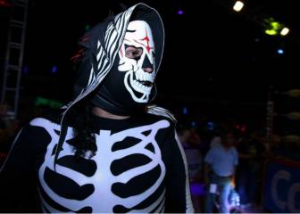 El accidente que envió a la Parka al hospital