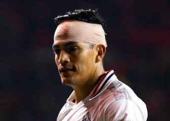 Chapo Sánchez, al quirófano por golpe en el ojo