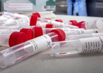 Las medidas de Campeche para llegar al color amarillo