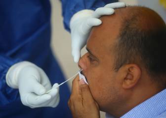 El dolor testicular podría ser otro síntoma de COVID-19