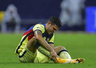 América enfrentará a Pumas con seis bajas