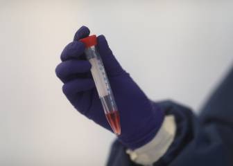 SSA : Debemos prepararnos para un repunte de COVID-19