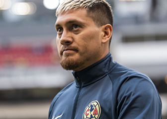 Castillo será operado nuevamente; en América son pacientes