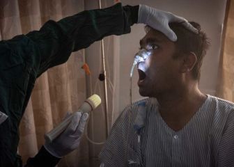 Estudio de UNAM señala que el hongo negro se encuentra en el ambiente