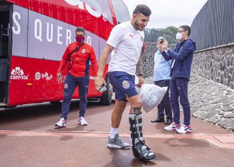 Las bajas de América y Chivas para el Clásico Nacional