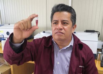 Investigadores del IPN desarrollan biosensor para diagnosticar daño renal